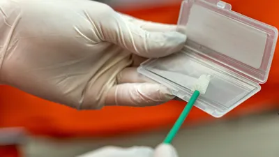 Cytologia konwencjonalna (klasyczna)