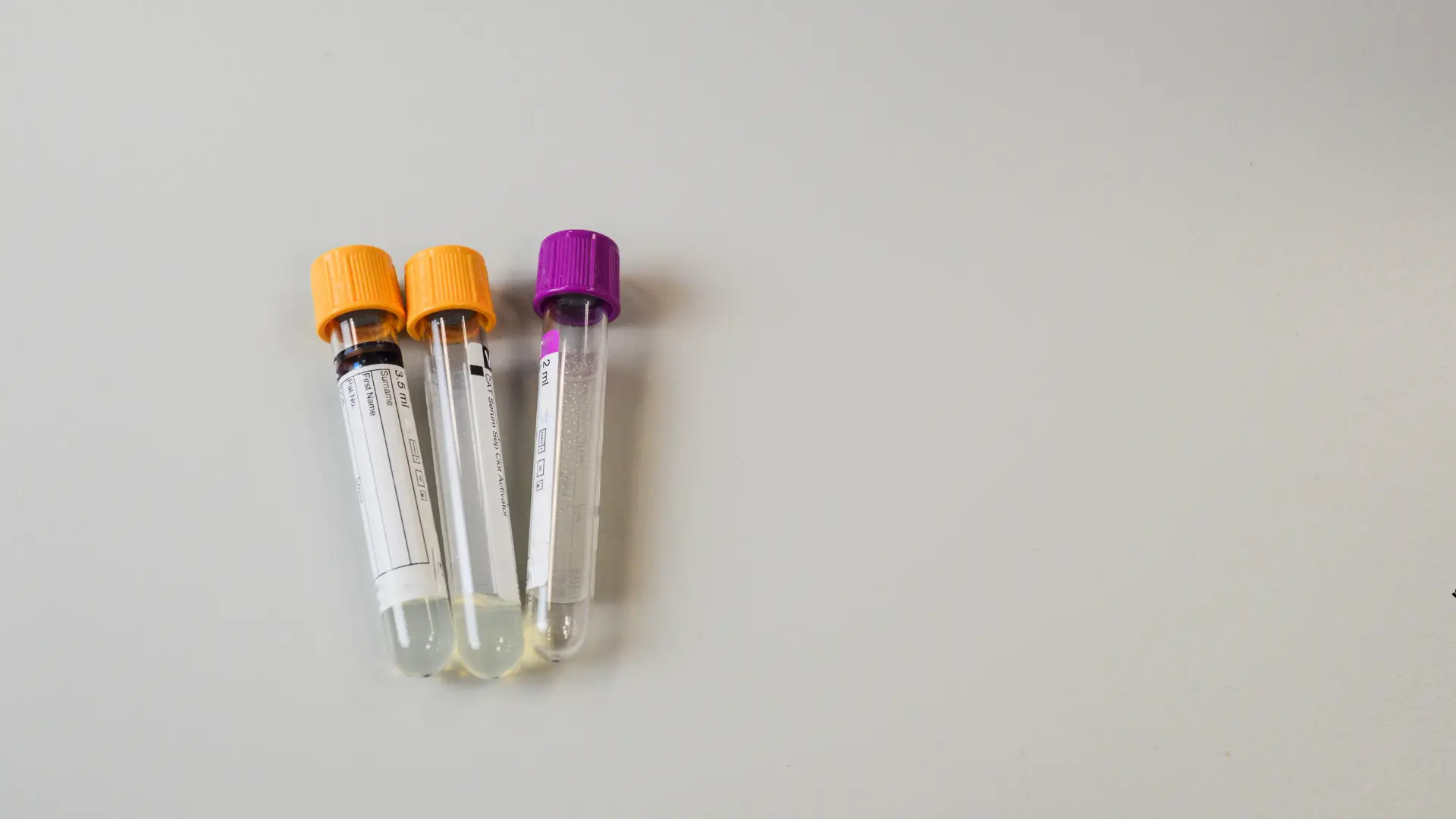 Badania laboratoryjne w CM Femmemedica