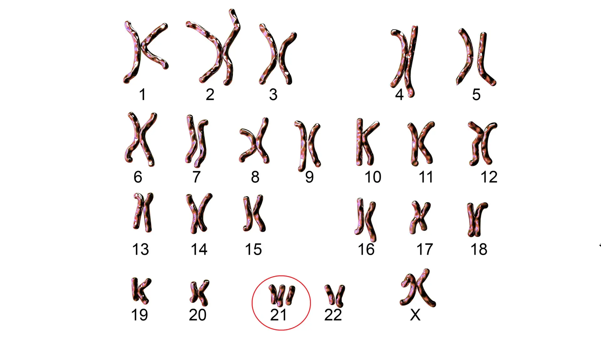 Usługa Komputerowa ocena ryzyka w kierunku trisomii 13,18, 21 w CM Femmemedica