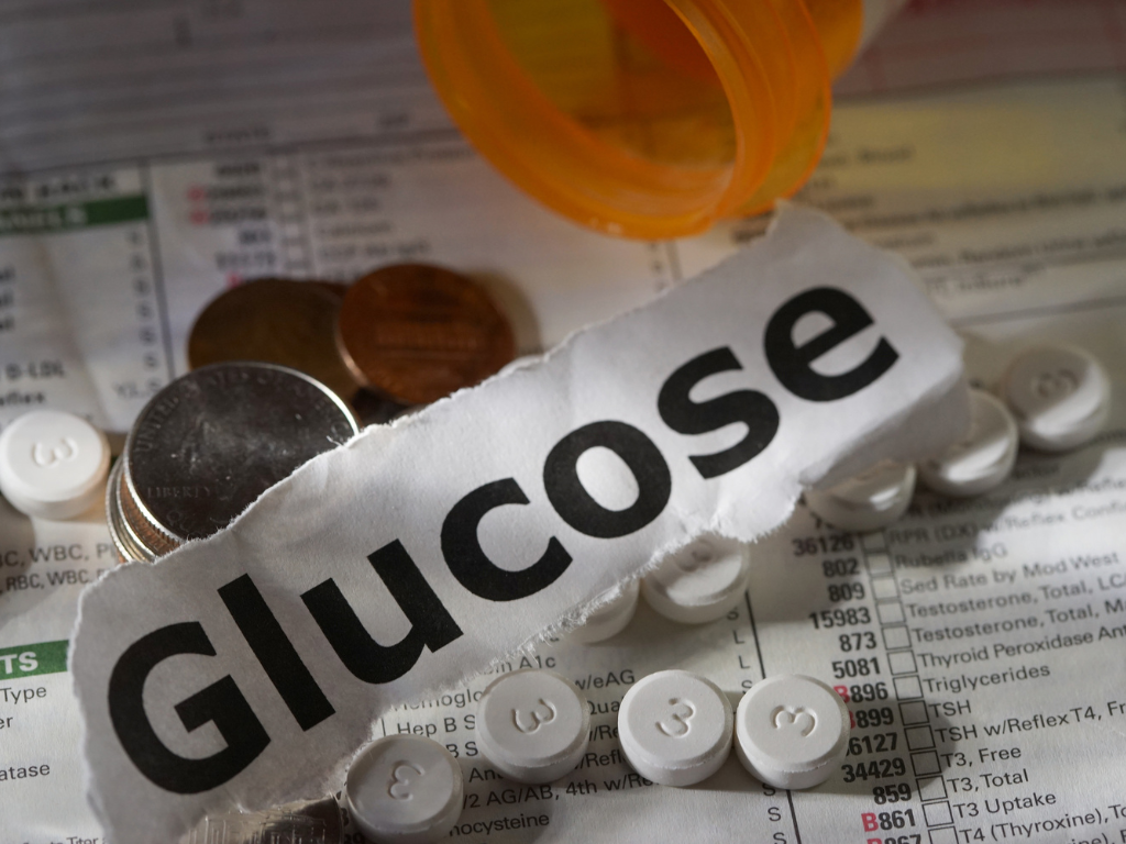 Gdzie Zrobić Krzywą Cukrową (OGTT) w Krakowie? Przewodnik Pacjenta