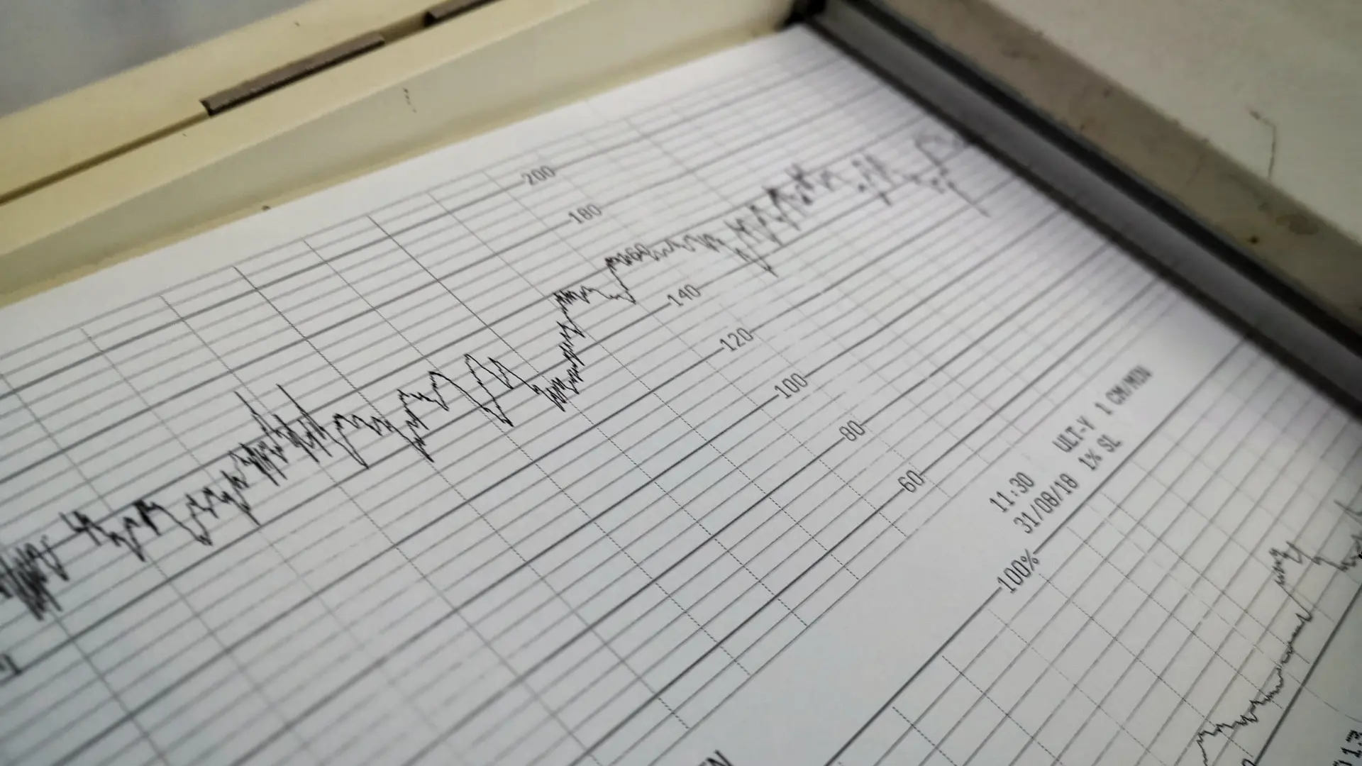 Usługa KTG w CM Femmemedica