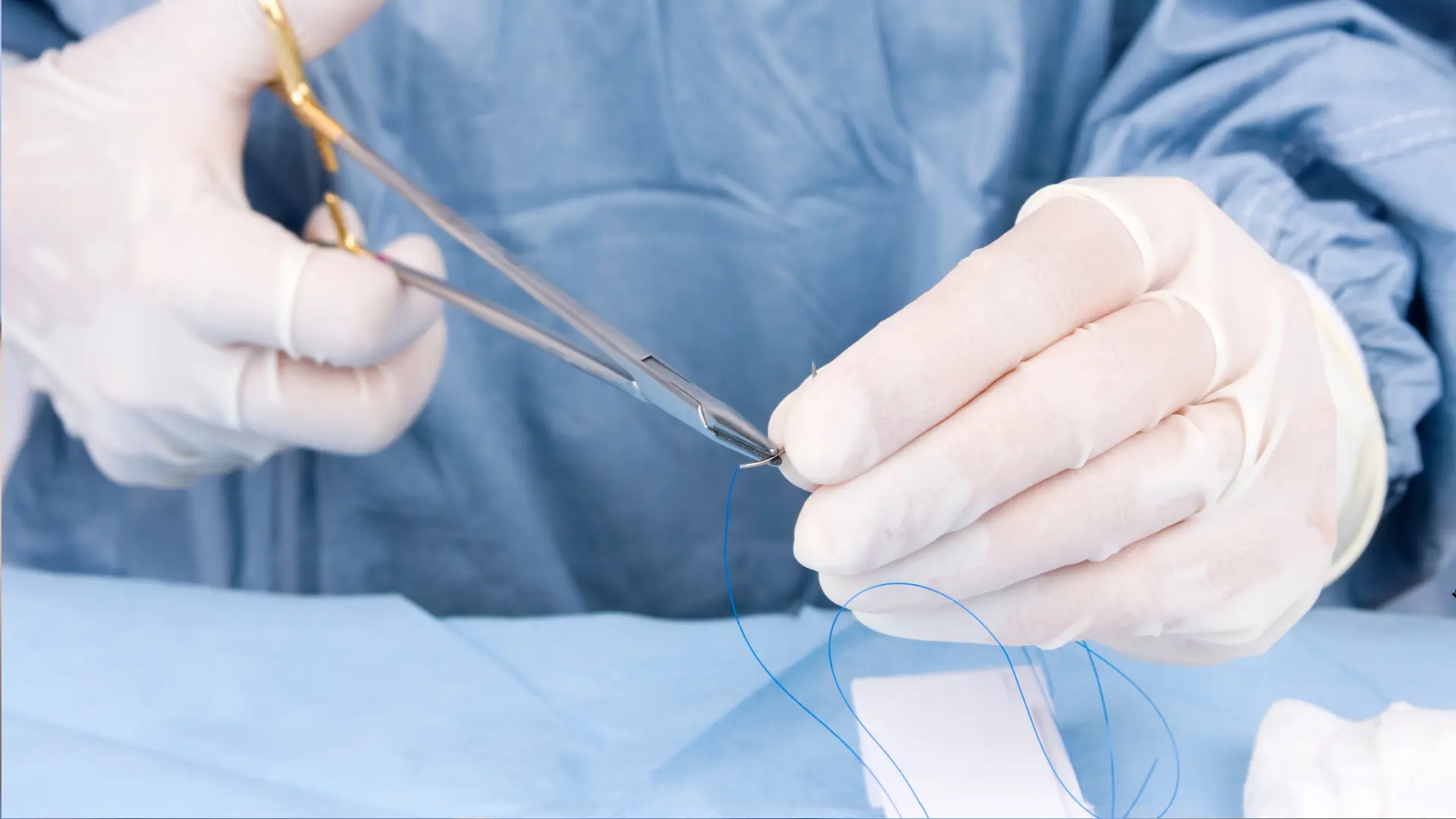 Usługa Zmiana opatrunku / usunięcie szwów w CM Femmemedica