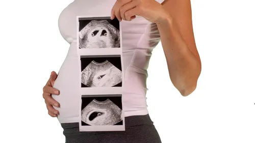 Pakiet: Pakiet pierwszy trymestr - rozszerzony