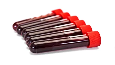 Panel 3 Infekcji Intymnych PCR (Chlamydia, Mycoplasma gen., Ureaplasma)