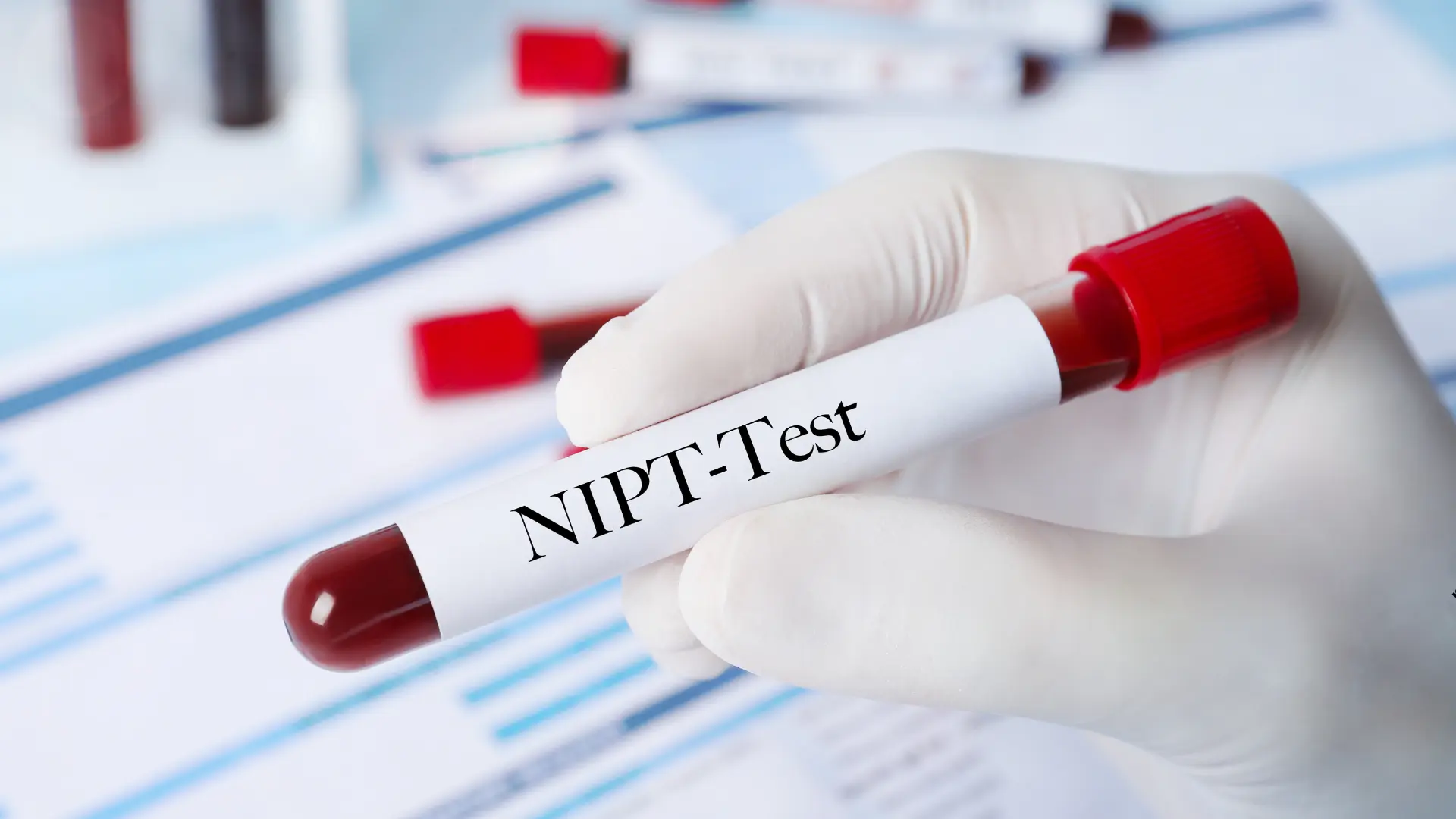 Nieinwazyjne Testy Prenatalne NIPT w CM Femmemedica w Krakowie