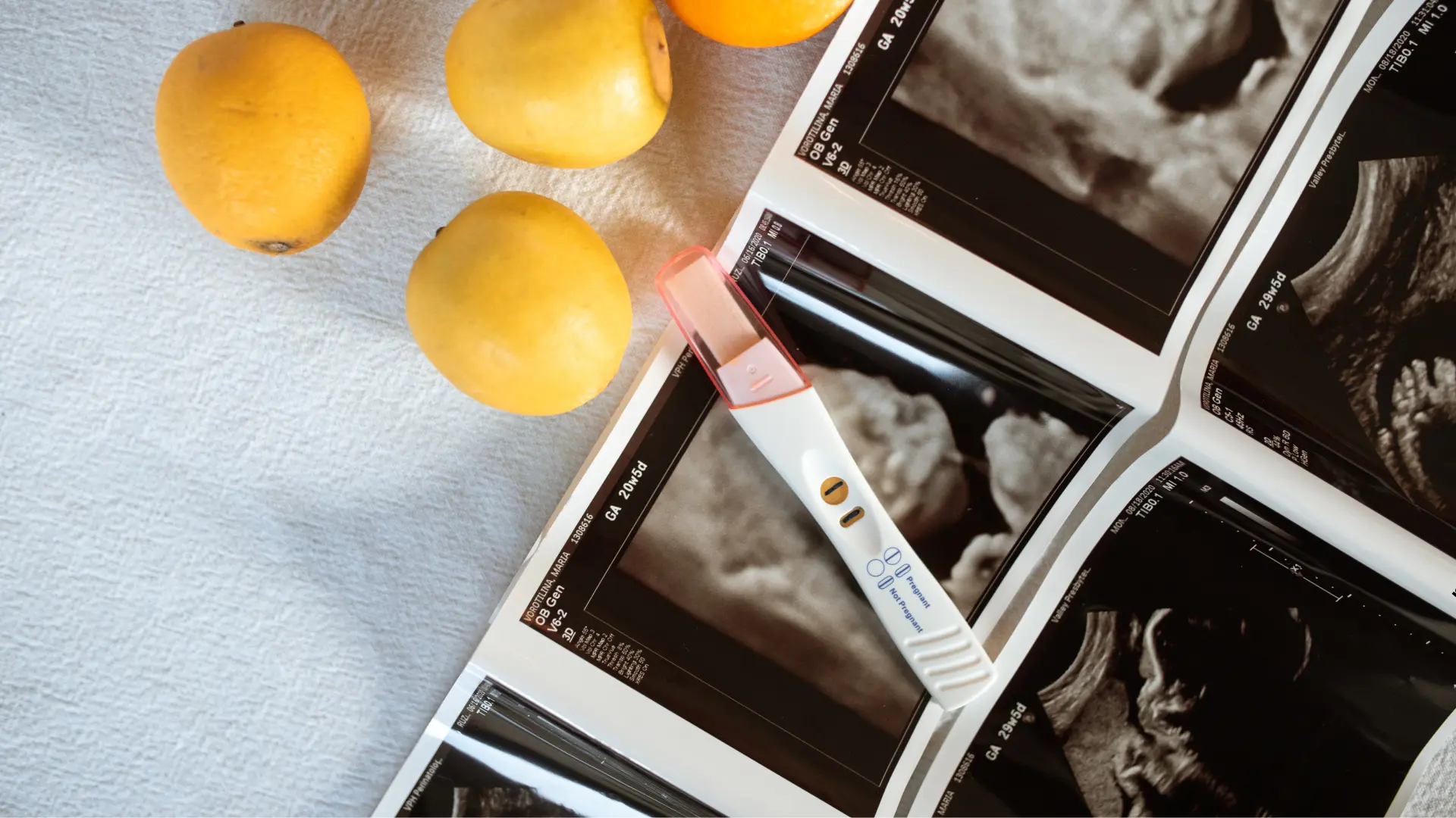 Usługa USG położnicze w CM Femmemedica