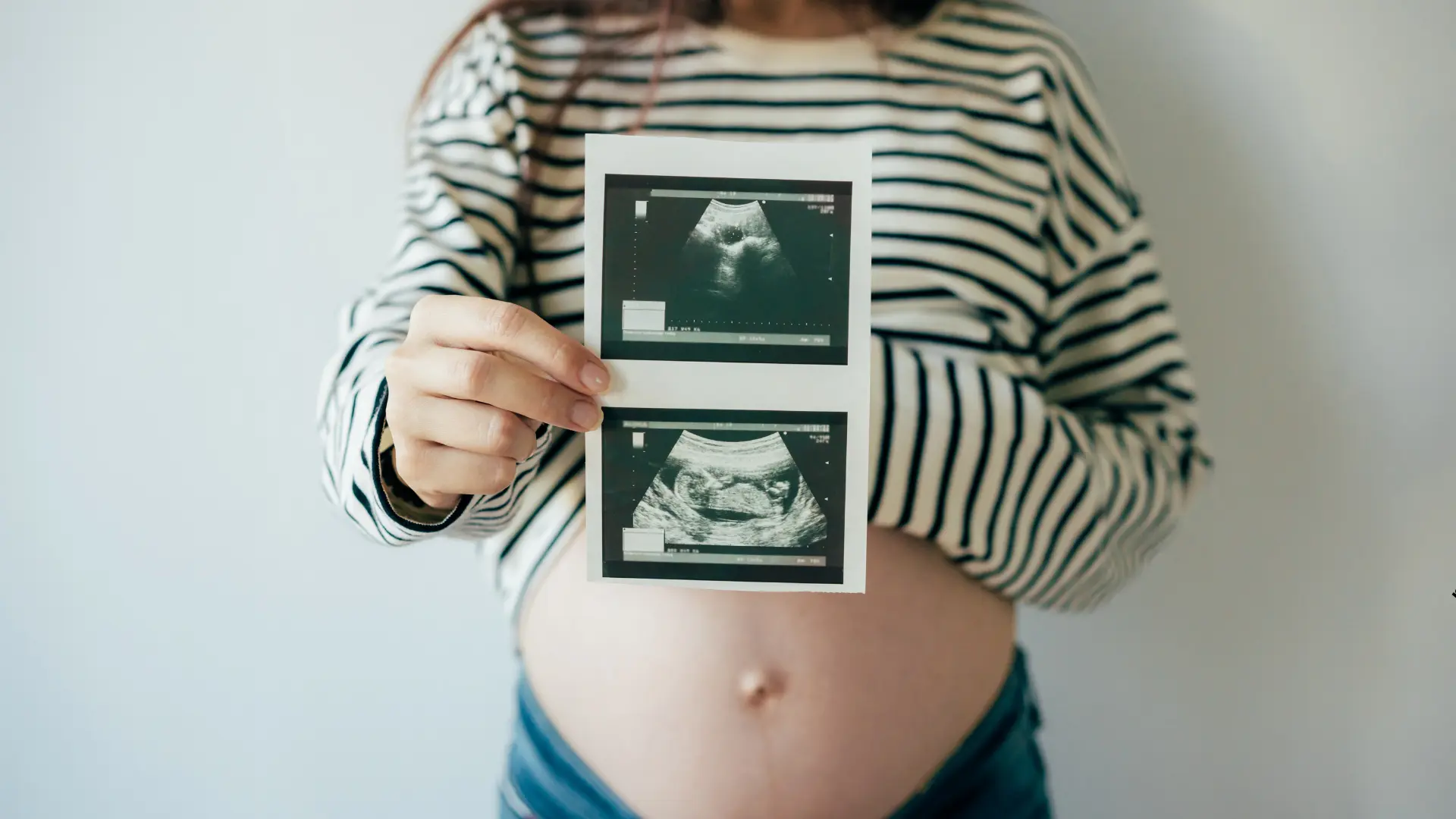 Badania USG prenatalne w CM Femmemedica Kraków