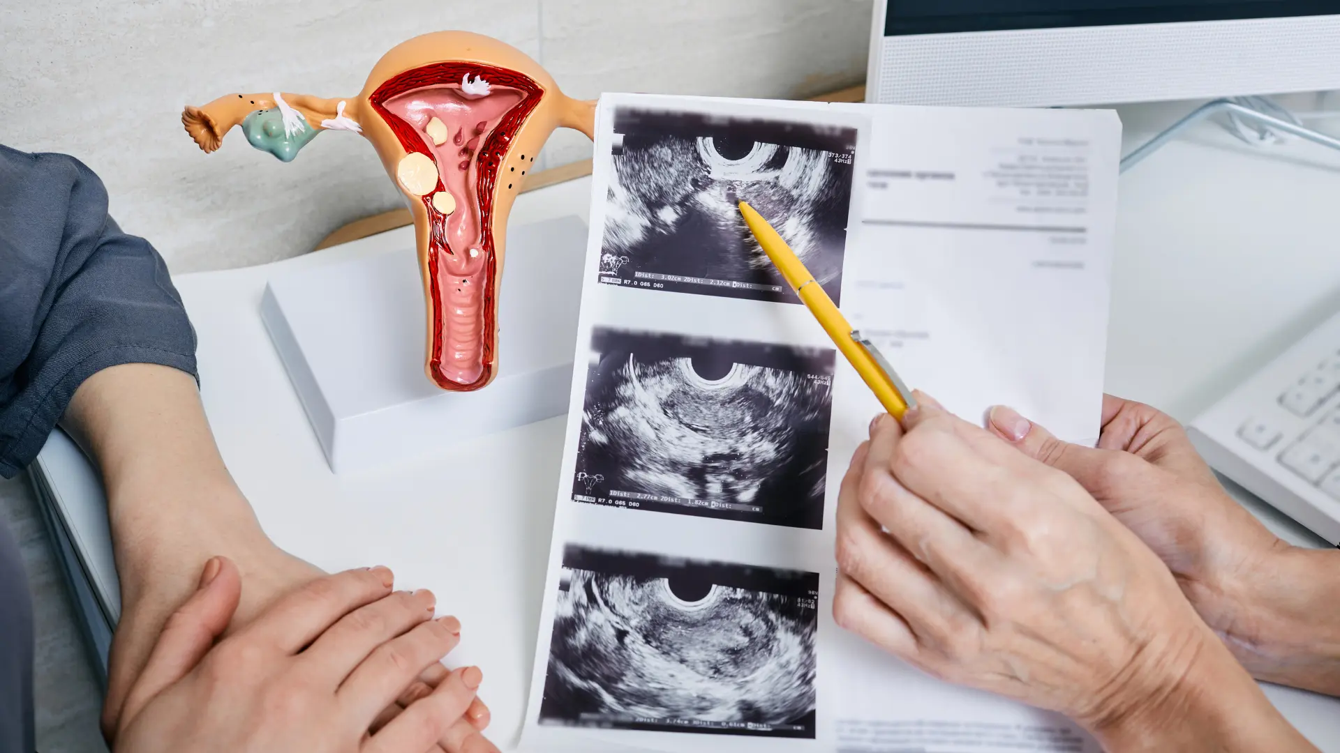 Usługa Wizyta ginekologiczna z USG w CM Femmemedica